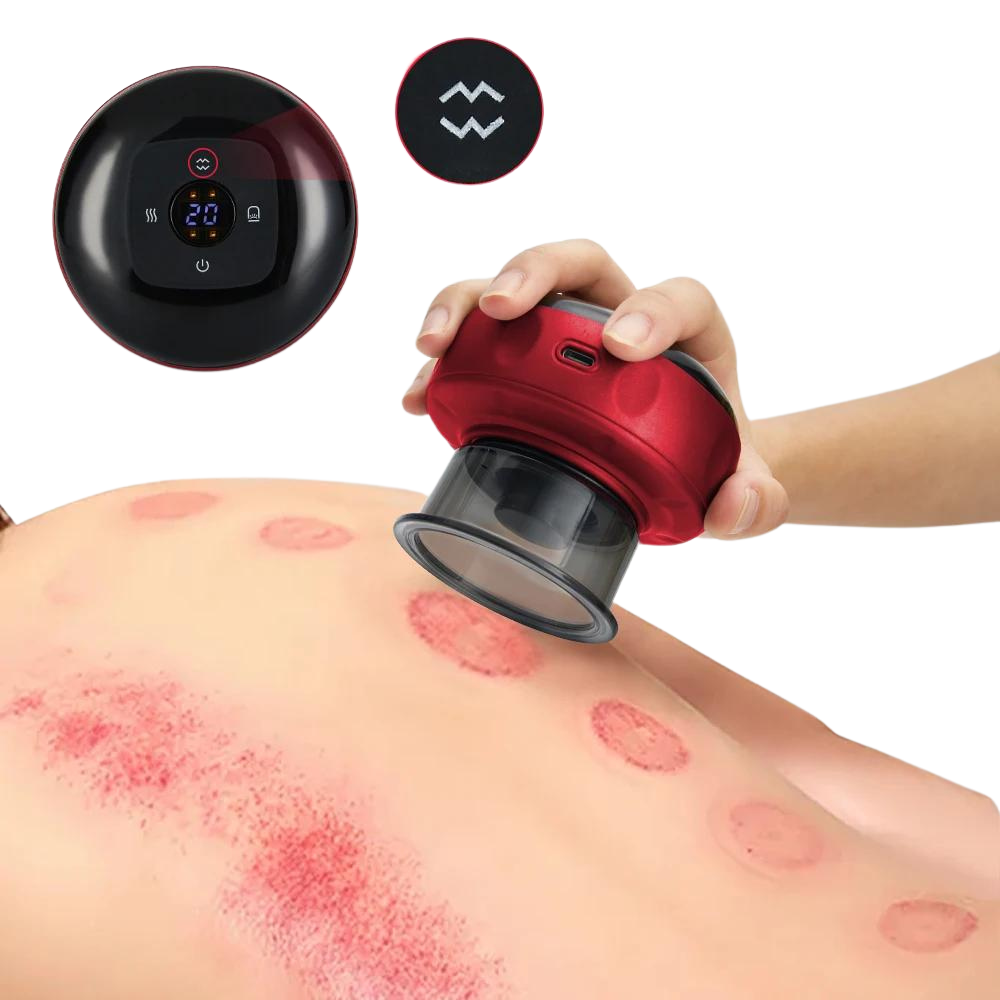 Electric Vacuum Cupping Massage