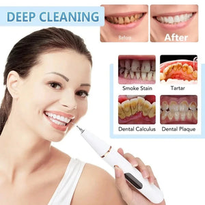 Electric Dental Calculus Remover - Ultrasound Stains Teeth Polishing